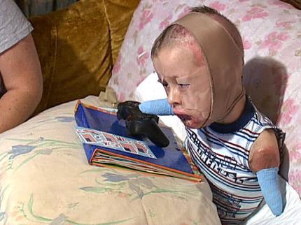 Oologah Meningitis Survivor Returns To Cincinnati Hospital For Checkup
