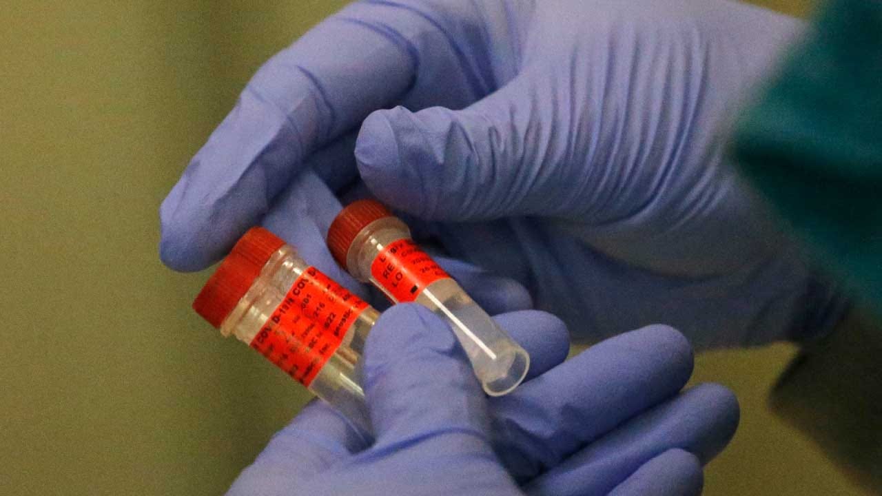 481 Total Positive Coronavirus Cases In Oklahoma, Total Number Of Deaths At 17, OSDH Reports