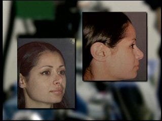 Woman fixes undesired plastic surgery results