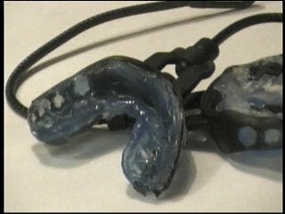 OSU research shows mouth guards house bacteria