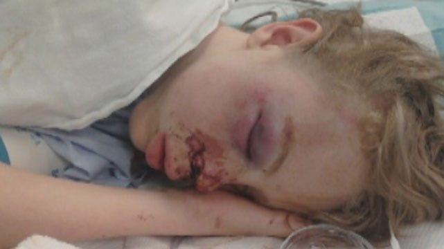 Enid Teen Injured In Fight With Classmate Released From Hospital