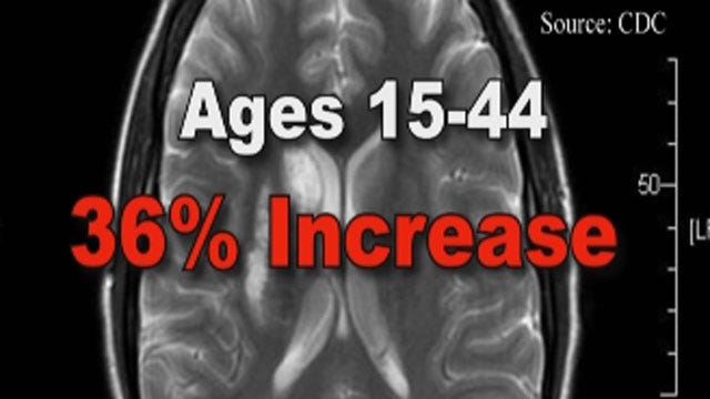 Stroke Risk Increasing Among Younger Patients In Oklahoma